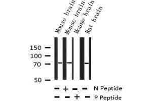Western blot analysis of Phospho-LIMK1/2 (Thr508/505) expression in various lysates (LIMK-1/2 (pThr505), (pThr508) antibody)