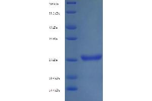 KIR2DS1 Protein (AA 22-245) (His tag)