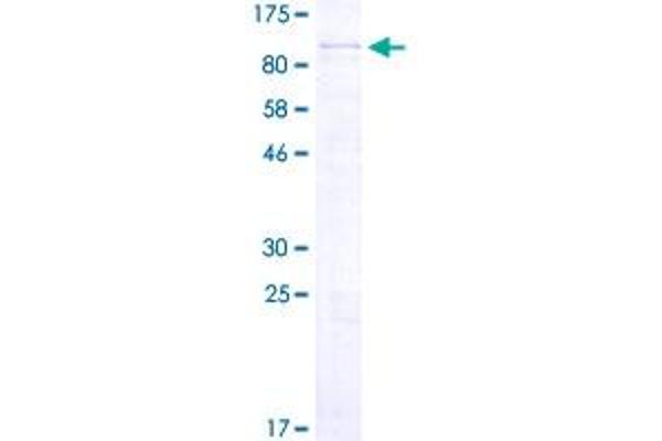 PPM1D Protein (AA 1-605) (GST tag)