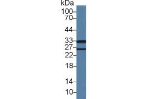 Western Blot; Sample: Mouse Lung lysate; Primary Ab: 1µg/ml Rabbit Anti-Mouse LDLRAP1 Antibody Second Ab: 0. (LDLRAP1 antibody  (AA 1-308))