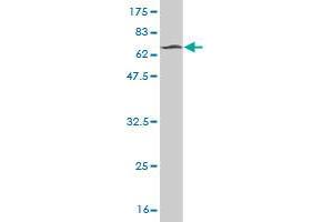Western Blot detection against Immunogen (66. (STK32C antibody  (AA 1-369))