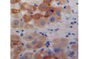 Used in DAB staining on fromalin fixed paraffin-embedded Liver tissue (AGR2 antibody  (AA 21-175))