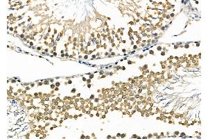 ABIN6259062 and ABIN6273551 at 1/100 staining Rat testis tissue by IHC-P.