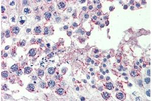 Testis, Human: Formalin-Fixed, Paraffin-Embedded (FFPE) (CPXCR1 antibody  (AA 396-445))
