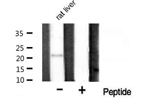 Western blot analysis on rat liver tissue lysate using Bax Antibody (BAX antibody  (Internal Region))