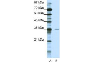 WB Suggested Anti-MBD2 Antibody Titration:  0. (MBD2 antibody  (Middle Region))