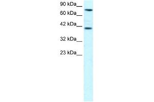 WB Suggested Anti-ZNF652 Antibody Titration: 0. (ZNF652 antibody  (N-Term))