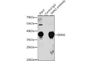 Immunoprecipitation analysis of 200 μg extracts of 293T cells, using 3 μg SMN2 antibody (ABIN6127949, ABIN6148136, ABIN6148139 and ABIN6218739). (SMN2 antibody  (AA 1-197))