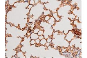 Immunohistochemistry (IHC) image for anti-GATA Binding Protein 4 (GATA4) (pSer262) antibody (ABIN6256227)