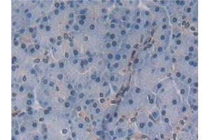 Immunohistochemistry (IHC) image for anti-Interleukin 5 (IL5) (AA 20-134) antibody (ABIN7430837)