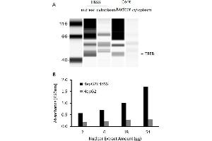 Transcription factor activity assay of TFEB from nuclear extracts of HepG2 cells or HepG2 cells treated with HBSS medium for 4 hr. (TFEB ELISA Kit)
