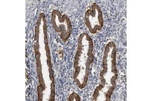 Immunohistochemical staining of human corpus, uterine with CMTM6 polyclonal antibody  strong cytoplasmic positivity in glandular cells. (CMTM6 antibody)