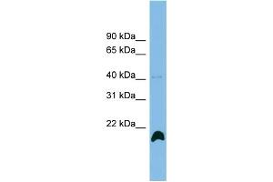 WB Suggested Anti-PPIH Antibody Titration: 0. (PPIH antibody  (N-Term))