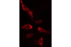 ABIN6275395 staining  HeLa cells by IF/ICC. (SLU7 antibody  (Internal Region))