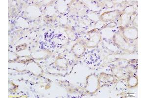 Formalin-fixed and paraffin embedded mouse kidney tissue labeled with Anti-TNFSF18 Polyclonal Antibody, Unconjugated  at 1:200 followed by conjugation to the secondary antibody and DAB staining (TNFSF18 antibody  (AA 101-199))