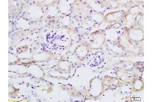 Formalin-fixed and paraffin embedded mouse kidney tissue labeled with Anti-TNFSF18 Polyclonal Antibody, Unconjugated  at 1:200 followed by conjugation to the secondary antibody and DAB staining