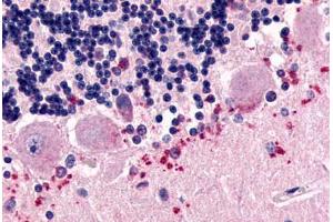Anti-CELSR3 antibody  ABIN1048436 IHC staining of human brain, Purkinje cell layer. (CELSR3 antibody  (N-Term))