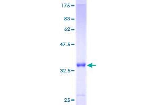 S100A6 Protein (AA 1-90) (GST tag)