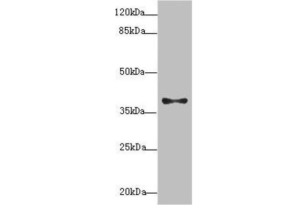 PDCD2L 抗体  (AA 1-358)