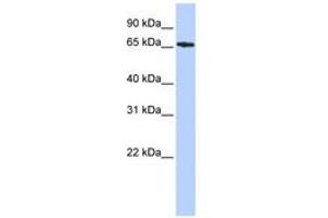 Image no. 1 for anti-serologically Defined Colon Cancer Antigen 8 (SDCCAG8) (AA 359-408) antibody (ABIN6743631) (SDCCAG8 antibody  (AA 359-408))