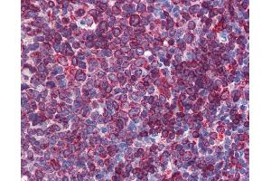 Anti-SC5DL antibody IHC of human tonsil. (SC5DL antibody  (AA 71-120))