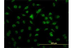 Immunofluorescence (IF) image for anti-Retinoblastoma Binding Protein 4 (RBBP4) (AA 316-426) antibody (ABIN562599)