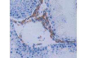 Used in DAB staining on fromalin fixed paraffin- embedded Kidney tissue (METTL21C antibody  (AA 1-248))