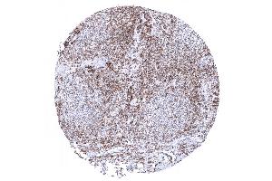 tonsil (CD27 antibody  (AA 28-170))