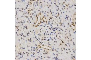 Immunohistochemistry of paraffin-embedded rat kidney tissue using H3K79me3 antibody at dilution of 1:200 (x400 lens). (Histone 3 antibody  (H3K79me3))