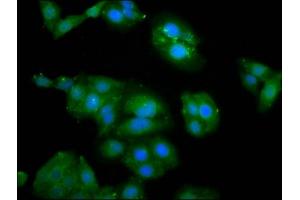Immunofluorescence staining of HepG2 cells with ABIN7176651 at 1:100, counter-stained with DAPI. (ZFR antibody  (AA 150-268))
