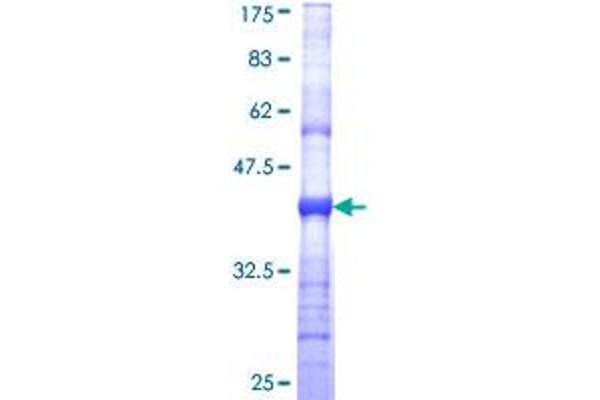 KCNJ10 Protein (AA 276-379) (GST tag)