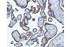IHC analysis of CD55 using anti-CD55 antibody (ABIN7601422).