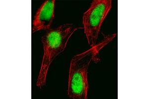 Fluorescent image of Hela cell stained with HOXC10 Antibody (C-term) (ABIN1881429 and ABIN2838971).