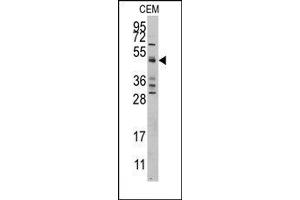 Image no. 1 for anti-Caspase 9, Apoptosis-Related Cysteine Peptidase (CASP9) (Middle Region) antibody (ABIN360397) (Caspase 9 antibody  (Middle Region))