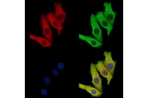 ABIN7095033 and ABIN7099089 staining Hela cells by IF/ICC.