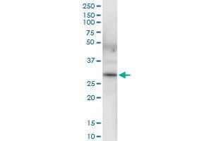 Immunoprecipitation of BDH1 transfected lysate using anti-BDH1 MaxPab rabbit polyclonal antibody and Protein A Magnetic Bead , and immunoblotted with BDH1 purified MaxPab mouse polyclonal antibody (B01P) . (BDH1 antibody  (AA 1-343))