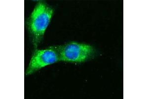 Human Melanoma cell line C 32 was cultured overnight on round cover slides placed in a 24 well tissue culture plate. (CD36 antibody  (Extracellular Domain))