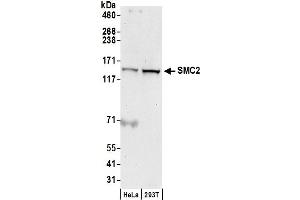 anti-Structural Maintenance of Chromosomes 2 (SMC2) (AA 50-100) antibody