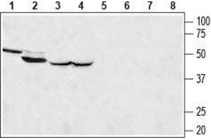 Western blot analysis of rat kidney (lanes 1 and 5), rat skeletal muscle (lanes 2 and 6), rat brain (lanes 3 and 7) and mouse brain (lanes 4 and 8) lysates: - 1-4. (MCU antibody  (Mitochondrial Matrix))