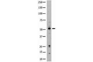 Image no. 1 for anti-Hemopoietic Cell Kinase (HCK) (N-Term) antibody (ABIN359984)