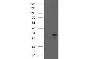 Western Blotting (WB) image for anti-Eukaryotic Translation Initiation Factor 4E (EIF4E) antibody (ABIN1497984) (EIF4E antibody)