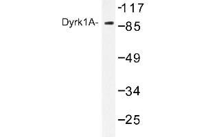 Image no. 1 for anti-Dual-Specificity tyrosine-(Y)-phosphorylation Regulated Kinase 1A (DYRK1A) antibody (ABIN272227) (DYRK1A antibody)