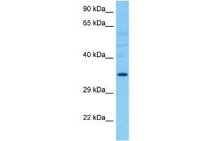 Host:  Rat  Target Name:  HSD11B1  Sample Tissue:  Rat Liver  Antibody Dilution:  1ug/ml (HSD11B1 antibody  (N-Term))
