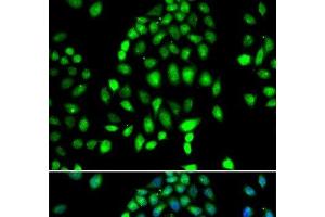 Immunofluorescence analysis of MCF-7 cells using PARP3 Polyclonal Antibody (PARP3 antibody)