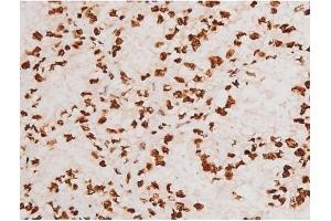 Immunohistochemistry (IHC) image for anti-REL proto-oncogene (c-Rel) (pSer503) antibody (ABIN6255382)