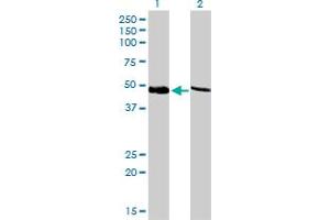 Western Blot analysis of PSMC4 expression in transfected 293T cell line by PSMC4 monoclonal antibody (M01), clone 3G8. (PSMC4 antibody  (AA 1-418))