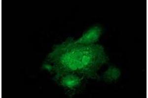 Anti-MAPRE2 mouse monoclonal antibody (ABIN2454497) immunofluorescent staining of COS7 cells transiently transfected by pCMV6-ENTRY MAPRE2 (RC200259). (MAPRE2 antibody)