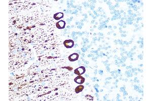 Immunohistochemistry (IHC) image for anti-Inositol 1,4,5-Trisphosphate Receptor, Type 1 (ITPR1) antibody (ABIN1679064)