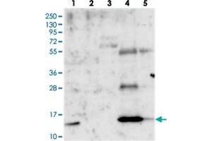 Western blot analysis of Lane 1: RT-4, Lane 2: U-251 MG, Lane 3: Human Plasma, Lane 4: Liver, Lane 5: Tonsil with PLAC8 polyclonal antibody . (PLAC8 antibody)
