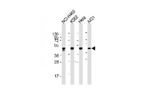 Western Blotting (WB) image for anti-Keratin 18 (KRT18) (AA 401-430), (C-Term) antibody (ABIN391561)
